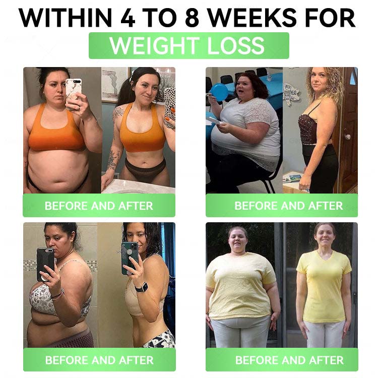 🌟alcuras_Moringa × Berberine × AMPK 8-Benefit Slimming & Metabolic Nano Microneedle Patch 🇺🇸  Just once a day · Visible changes in 7 days  ✅ For obesity, loose skin, diabetes, sleep apnea, joint issues, and more