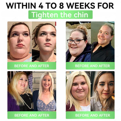 🌟alcuras_Moringa × Berberine × AMPK 8-Benefit Slimming & Metabolic Nano Microneedle Patch 🇺🇸  Just once a day · Visible changes in 7 days  ✅ For obesity, loose skin, diabetes, sleep apnea, joint issues, and more